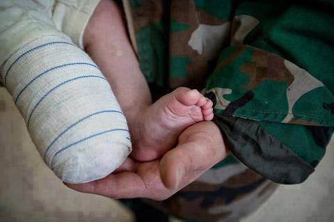baby-missing foot