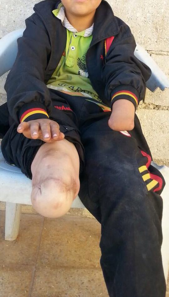 12250650_1280373478716860_420524883_o